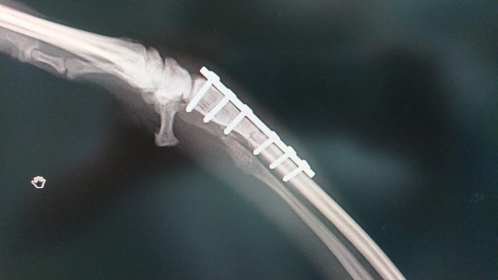 4～5月は骨折手術が多いです